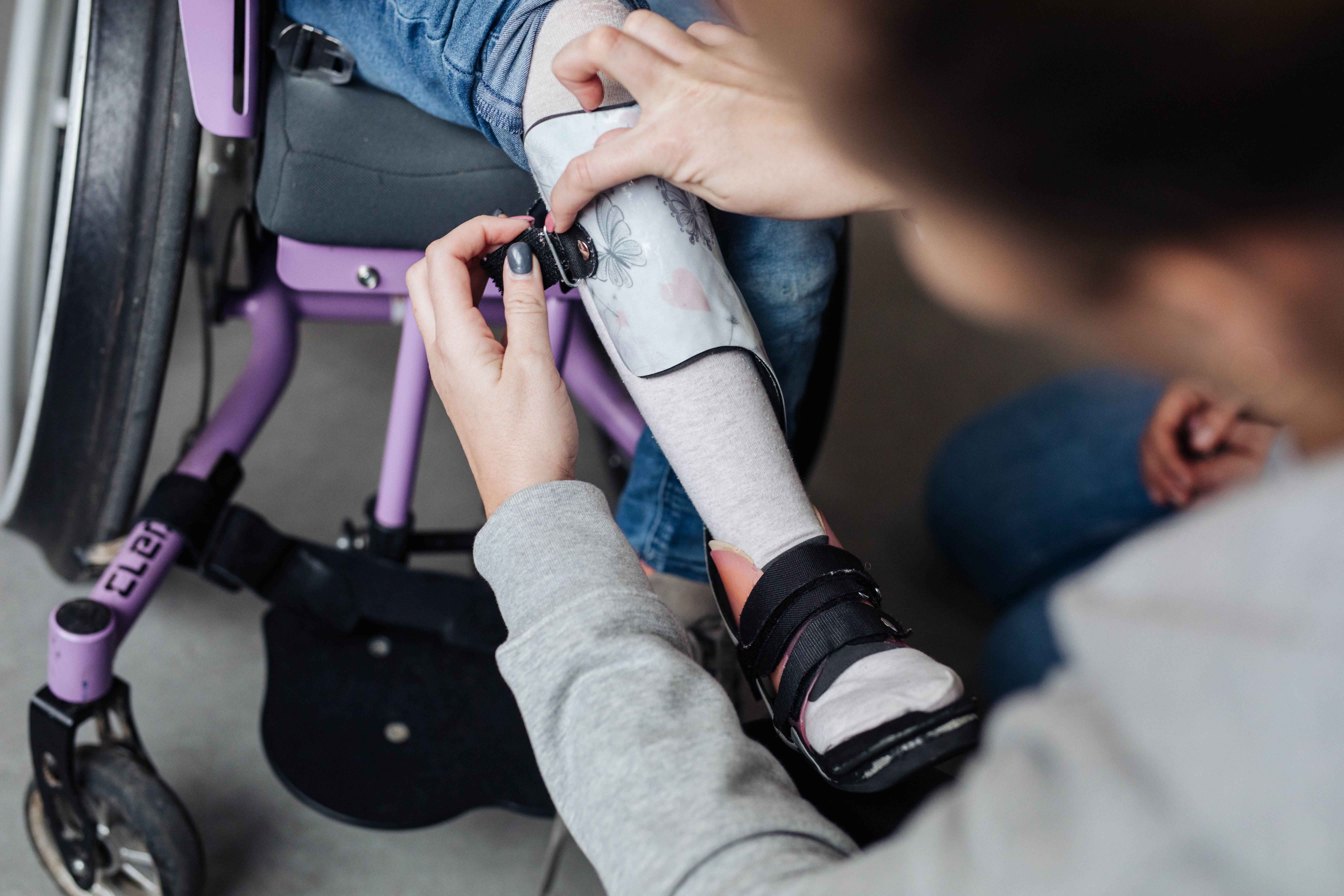 Die Orthese eines Mädchens im lilafarbenen Rollstuhl wird durch einen Hodey Kids Orthopädietechniker angepasst.